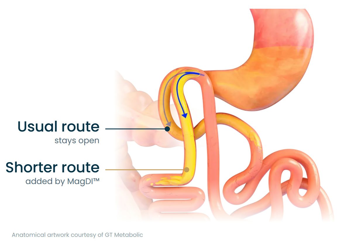 Your usual route stays open, and MagDI adds a shorter route for food